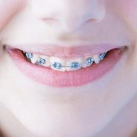 Coombe Orthodontics image 4